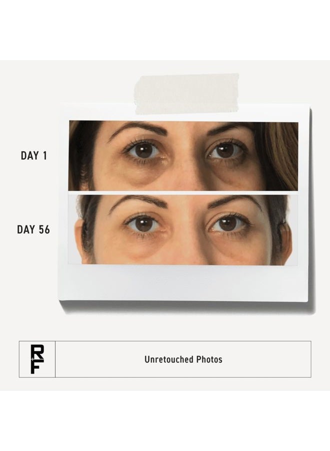 Rodan Fields Rodan + Fields ENHANCEMENTS Active Hydration Bright Eye Complex (15 mL/.5 US fl.oz.) - Image 3