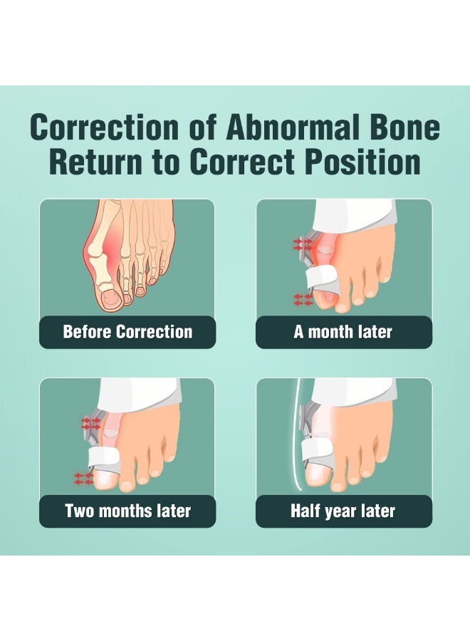 مصحح بونيون طبي لإبهام القدم للرجال والنساء – مقوم إصبع القدم الكبير لعلاج انحراف إبهام القدم وأصابع القدم المعوجة – دعامة تقويم بإعداد زاوية قابل للتعديل مع وسادة سيليكون داخلية – طقم قطعتين لتخفيف الألم والراحة اليومية - Image 3