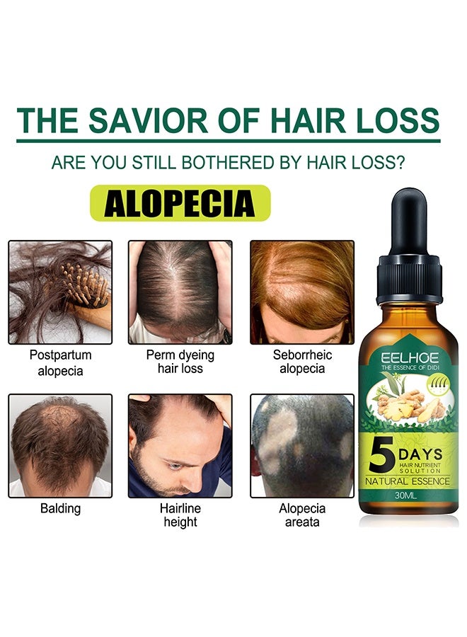 EELHOE Hair Nutrient Solution, for Hair Fall Hair Regrowth And Scalp, Treatment Ginger Essential Oil Supports Healthy Hair Thinning Treatment Hair Growth Oil for Men 30ML - Image 2