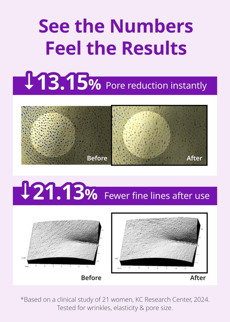SNP 10,000ppm Deep Collagen + PDRN + Retinol Hydrogel Mask | 8 Layer 125Da Collagen Face Mask | Overnight Facial Mask | Patent Skin Hydration | Hydrating Facial Mask | Face Mask Skin Care | 4 Sheets - Image 4