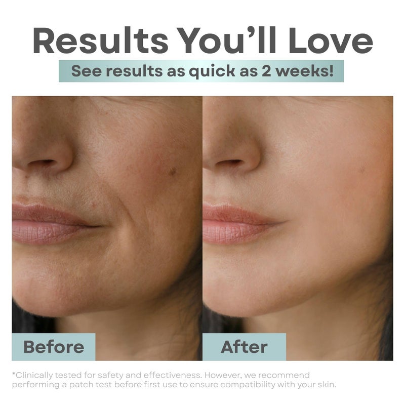 Clear Essence Antifungal Soap Cleansing Bar Plus Exfoliant 4.7oz - Extra Strength Medicated Soap for Acne, Oil & Impurities - Face & Body Wash Bar with Skin-Renewing Exfoliation, for Men and Women - Image 3