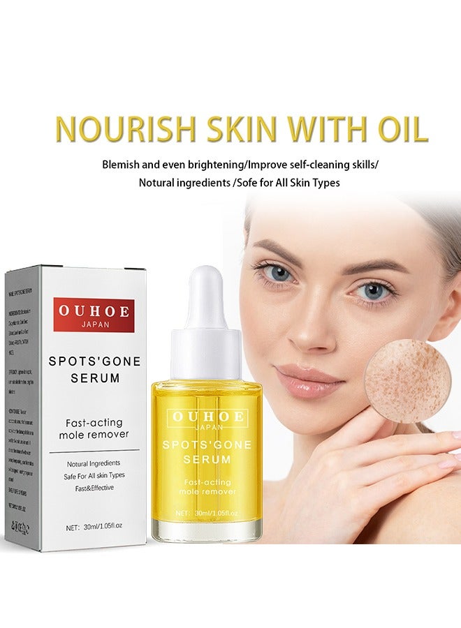 OUHOE Spot Gone Serum- lightening serum for Face and Body - Face Lightening and Brightening Serum 30ml - Image 1