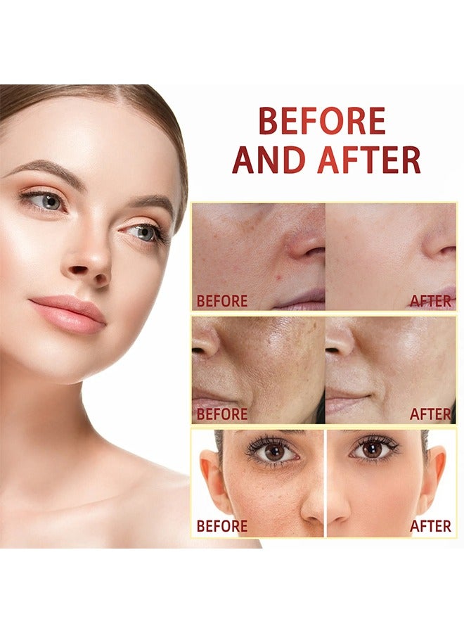 OUHOE Spot Gone Serum- lightening serum for Face and Body - Face Lightening and Brightening Serum 30ml - Image 3