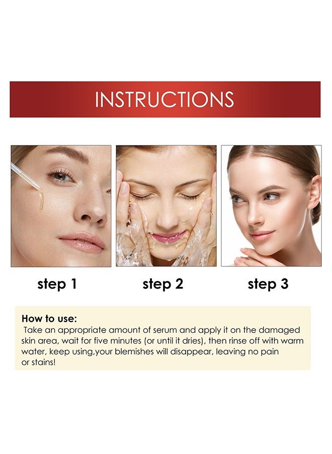 OUHOE Spot Gone Serum- lightening serum for Face and Body - Face Lightening and Brightening Serum 30ml - Image 5