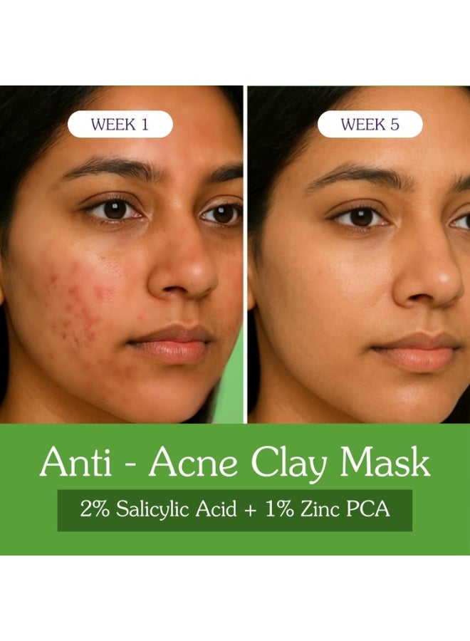 BAKE 2% Salicylic Acid Clay Mask Niacinamide for Acne Prone, Oily Skin, Open Pores & Blackheads | Anti Acne Clay Mask with Kaolin Clay | For Dark Spots, Oily Skin & Blemishes - 100g (Anti Acne) - Image 3