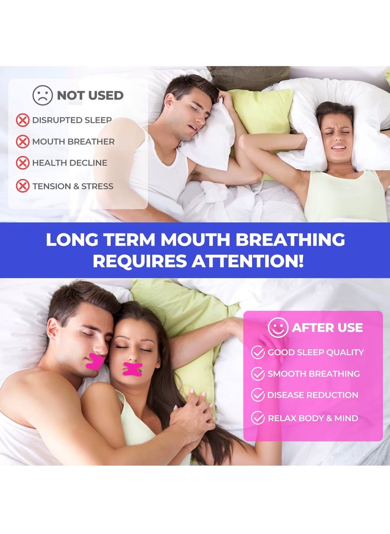 Sefudun 50 Pcs Micropore Tape Mouth Tape Sleep Strips Soft and Comfortable Gentle and Secure Adhesive Mouth Strips Nose Breathing Anti Snoring Better Breathing Oduor Free Sleep Strip Mouths Tape Pink  - Image 2