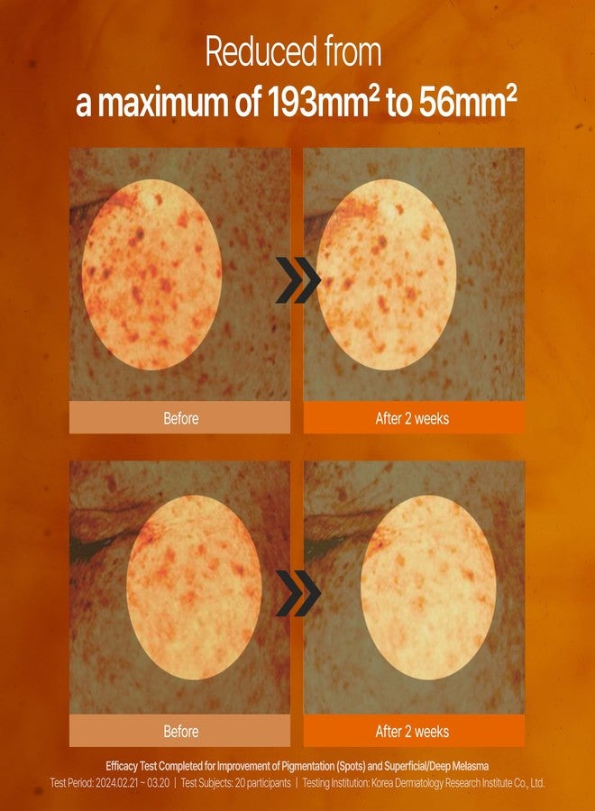 shaishaishai CAFFEINE SHOT Blemish Toning Serum, 10% Niacinamide & 5% Caffeine for Hyperpigmentation, Even Skin Tone, Reduced Pore Size and Puffiness, Pigmentation Care, Korean Skin Care, 1.01 Fl Oz - Image 4