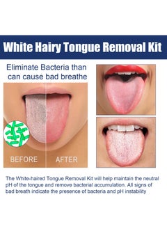 Jaysuing White Hairy Tongue Removal Kit, Tongue Cleaning Gel Set, Tongue Cleaner Gel With Tongue Brush, Tongue Scraper Scrubber For Adults With Cleaning Gel  - Image 2