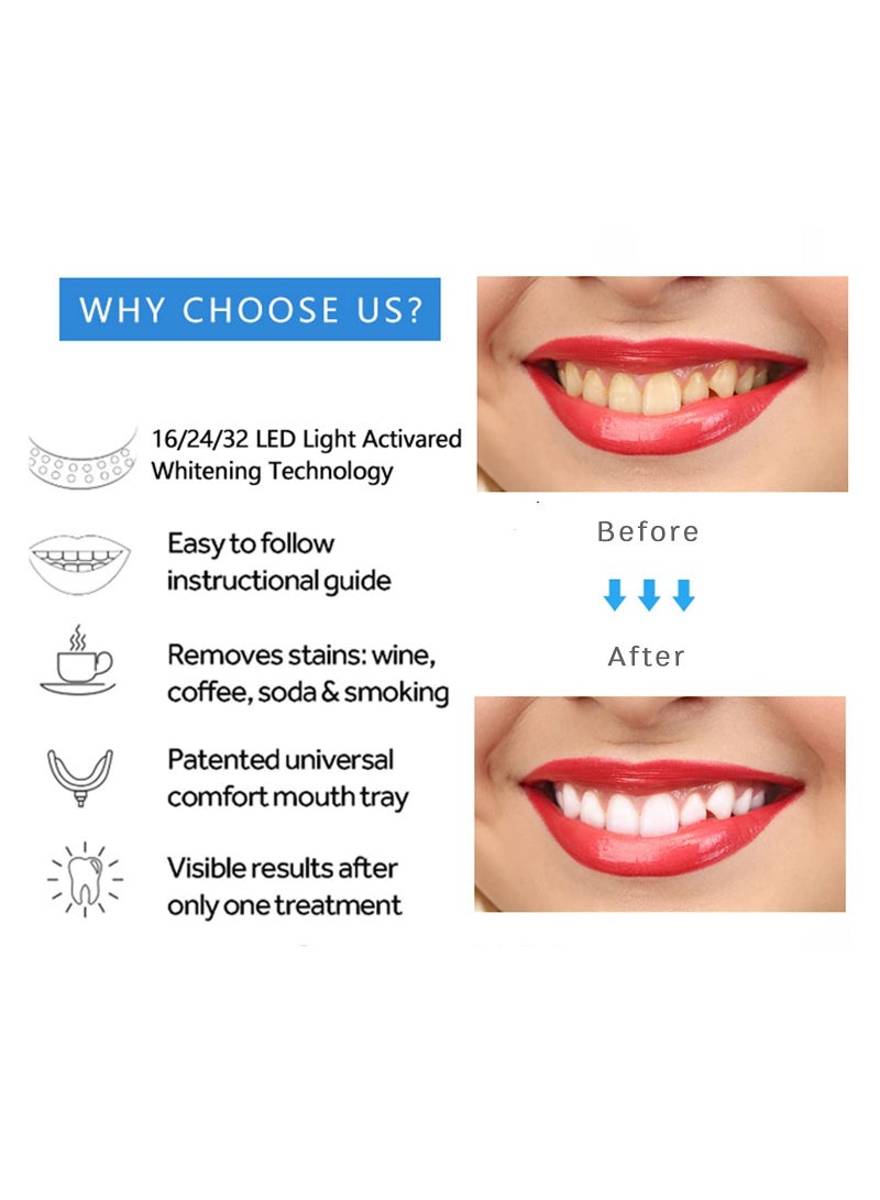 general 1 pcs Teeth Whitening Gel with LED Accelerator Light and Tray Teeth Whitener Helps to Remove Stains - Image 4