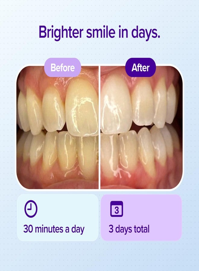 BURST Prefilled Teeth Whitening Trays (6 Trays/3 Treatments |15% Hydrogen Peroxide for Professional-Level Results | Flexible 360° Teeth Whitening Gel Trays | Aloe, Coconut & Xylitol Blend Teeth Trays - Image 3
