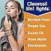 Clearasil Stubborn Acne Control 5in1 Daily Facial Cleansing Pads, with Salicylic Acid Acne Treatment Medicine, 90 Count - Image 3