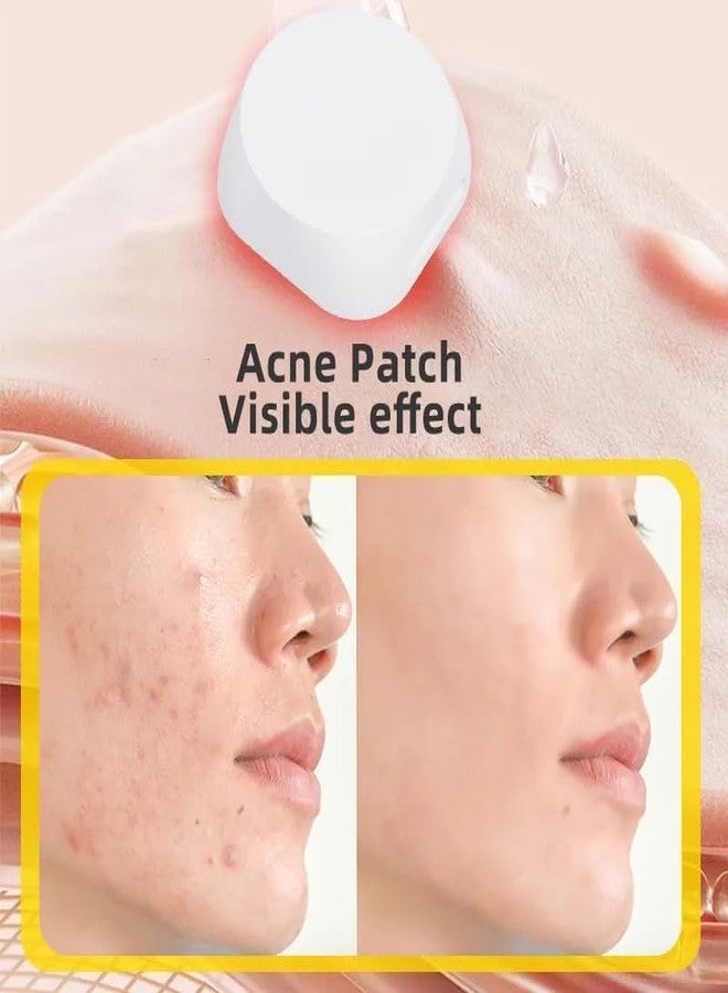 PEIPUS LED Light Therapy Acne Patch, 6-PACK, LED Red Light Acne Patches,Fast Acting Skin Care Pimple Patch Spot Regimen for Pimple, Use 6-8 hours - Image 3