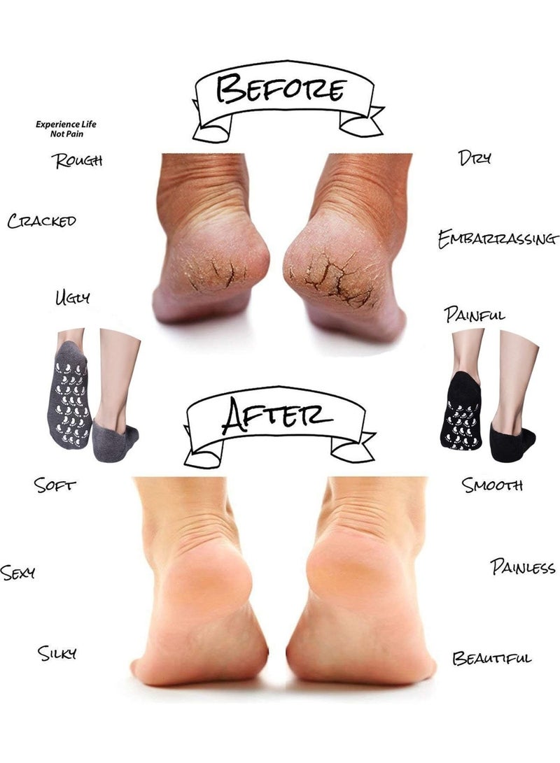 Moisturising Socks, Moisturising Gel Socks, Spa Socks with Essential Oils, Rose, Spa Gel Socks, Foot Care for Dry, Cracked Feet and Soften Dry Skin, 1 Pair - Image 4