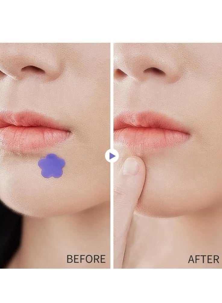 Kormesic مجموعة لاصقات حب الشباب 3 قطع سهلة الاستخدام شفاء سريع لاصقات خالية من الألم والندوب للوجه تعزز شفاء الجروح تركيبة طبيعية لاصقات حب الشباب (60 لاصقة) - Image 5