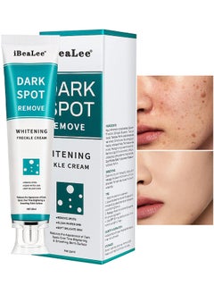 iBealee Dark Spot Remover For Face Peeling Skin Whitening Freckle Cream Pigmentation Treatment Sun Spots Age Spots Blemish Remover Lightening Cream  - Image 1