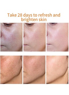 iBealee Dark Spot Remover For Face Peeling Skin Whitening Freckle Cream Pigmentation Treatment Sun Spots Age Spots Blemish Remover Lightening Cream  - Image 5