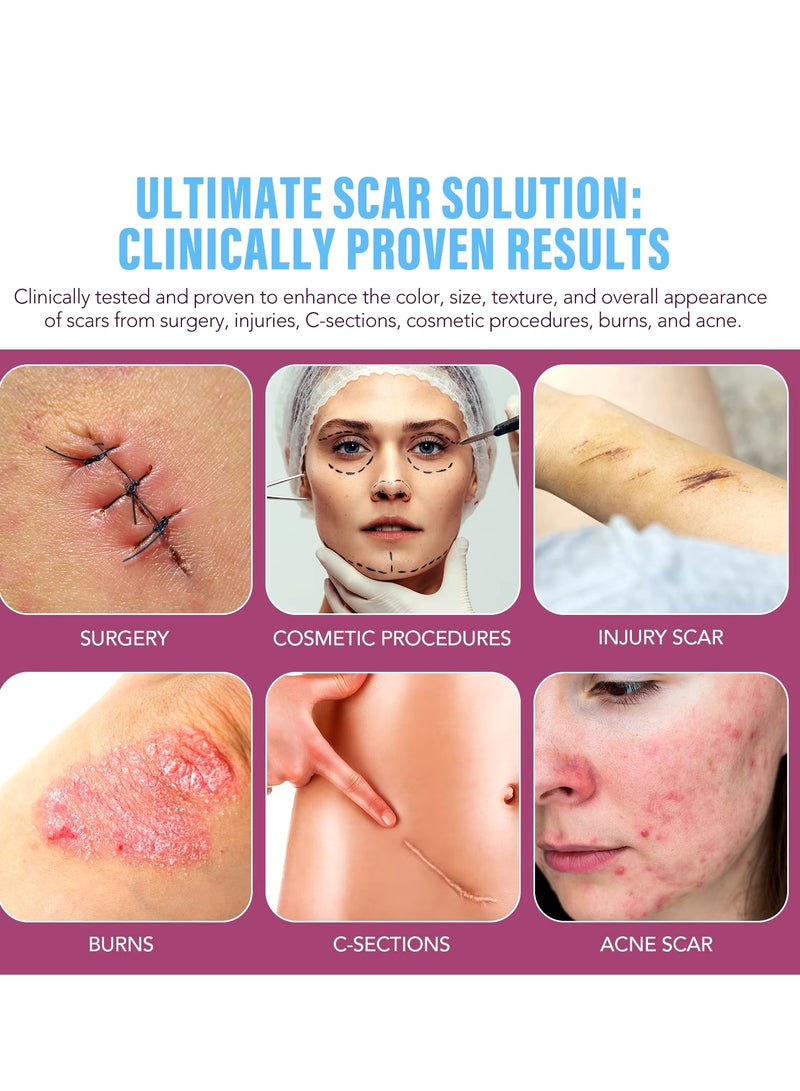 VOGSIG Silicone Scar Gel for Damaged Skin Dead Skin Elimination Surgery Scar Burns Acne Scars and Pregnancy Lines Deeply Moisturize Hydrates Smooths New and Old Scars Scar Removal Cream Gel 30g - Image 2