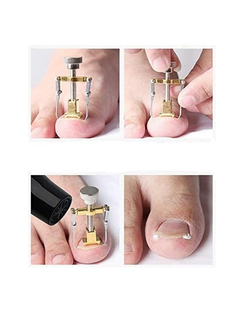 أداة تصحيح أظافر القدم الغارزة في اللحم من الفولاذ المقاوم للصدأ - Image 3