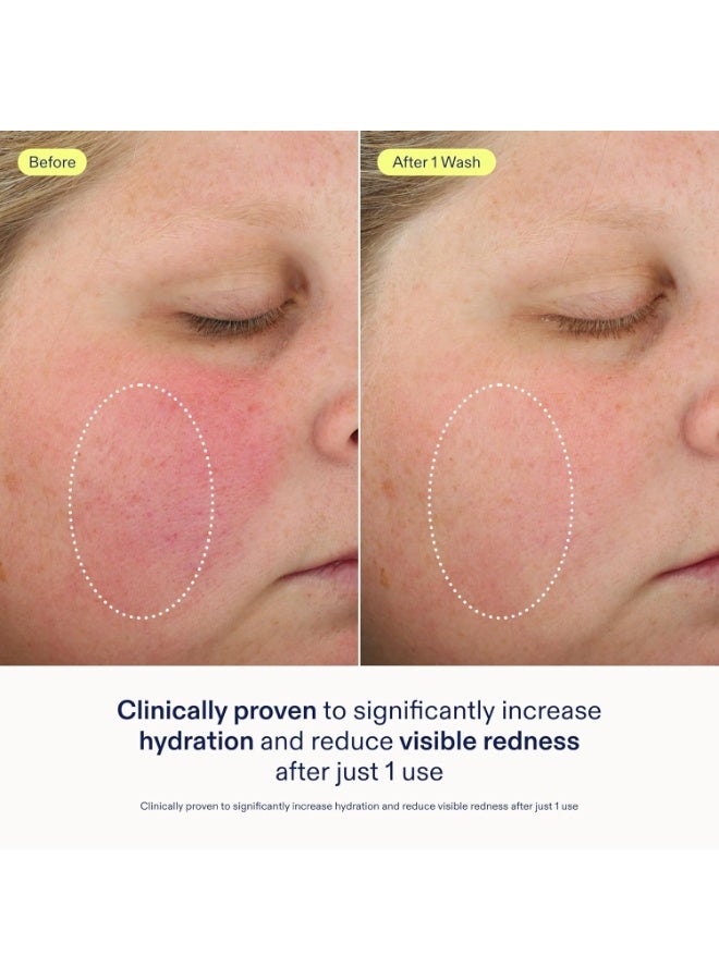 Skinfix منظف زيت رغوي للوجه من سكين فيكس - 6 أونصات - تركيبة غنية تتحول من جل إلى رغوة لترطيب وتهدئة البشرة الجافة والحساسة - خالي من العطور، نباتي، خالي من القسوة - Image 2