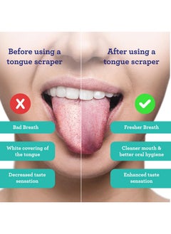 GuruNanda GuruNanda Tongue Scraper for Adults (2 Pack) with Travel Case, 420 Medical-grade 100% Stainless Steel Tongue Cleaner, Aids in Fresh Breath & Oral Care  - Image 3