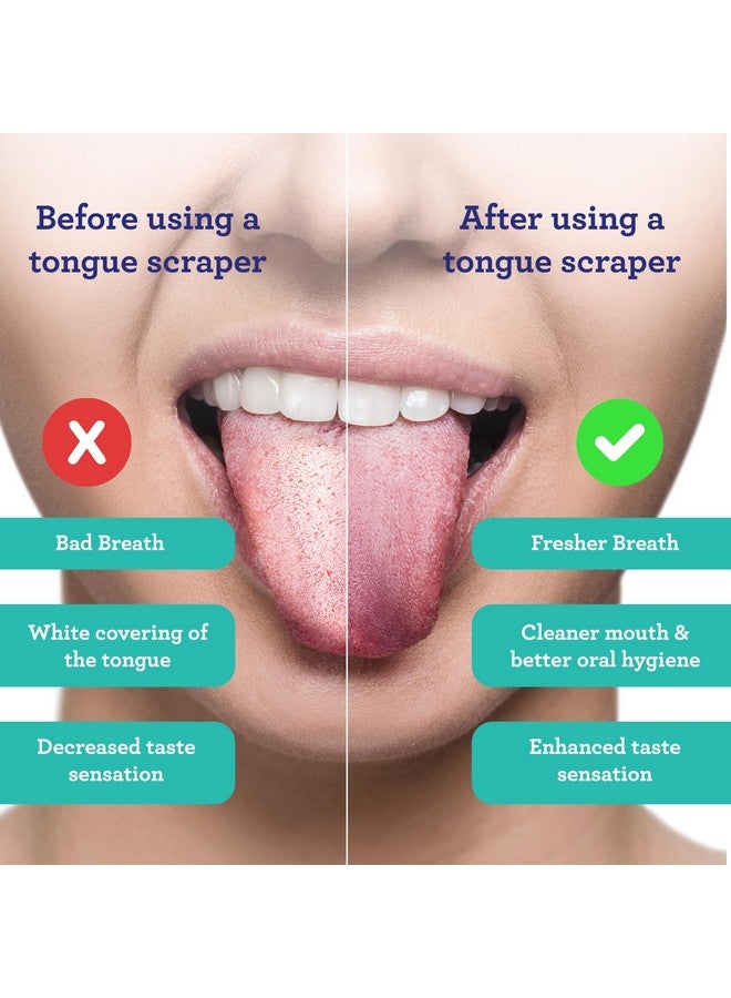 GuruNanda Tongue Scraper for Adults (2 Pack) with Travel Case, 420 Medical-grade 100% Stainless Steel Tongue Cleaner, Aids in Fresh Breath & Oral Care - Image 3