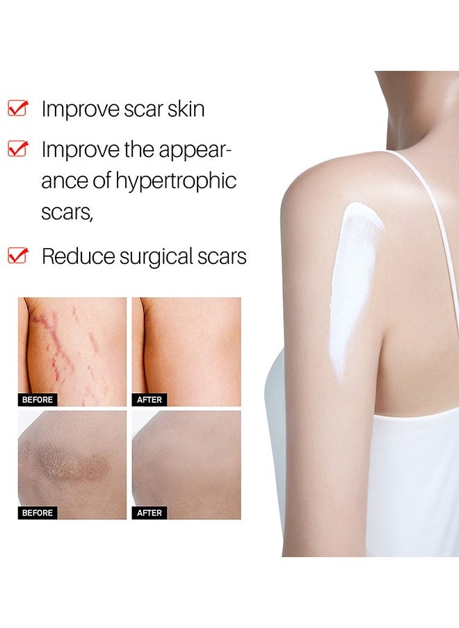 ASMOXA Silicone Scar Gel - Medical Grade Silicone Scar Cream Advanced Scar Removal Gel for Surgical Scars C Section Stretch Marks Acne Injury Burns Keloids Hypertrophic Old and New Scars 30ml  - Image 5