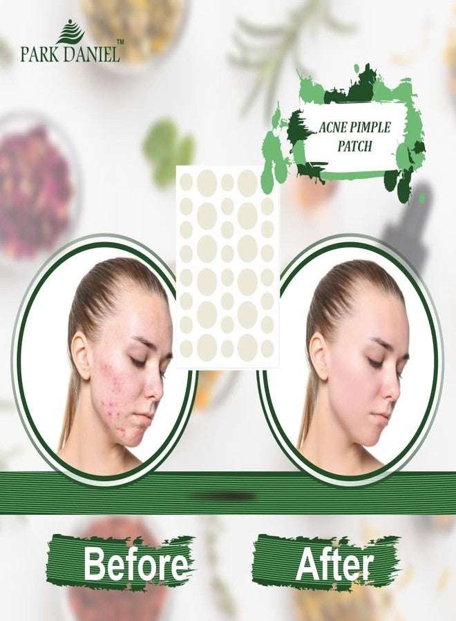 Park Daniel Pimple Patch Invisible Hydrocolloid Waterproof Patches for Face Zit Patch Acne Dots Pimple Overnight For All Skin Types 36 Invisible Facial Stickers Pack of 1 - Image 5