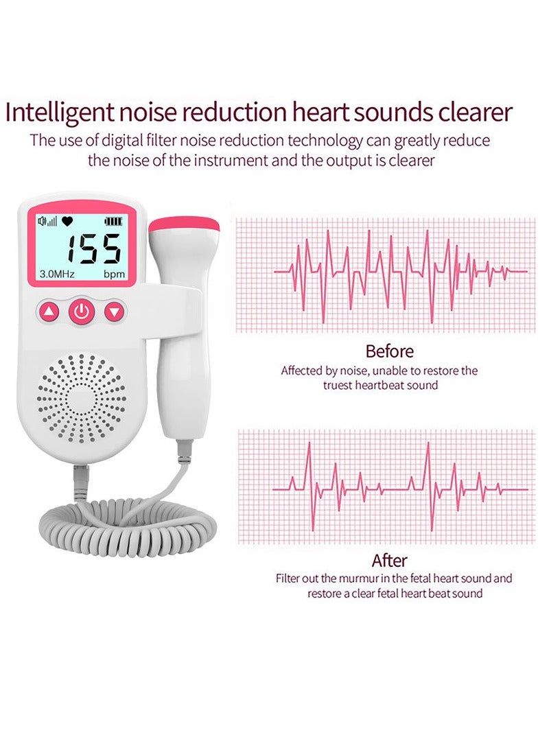 DURKU LCD Screen Portable Fetal Heart Rate Monitor Ultrasound Doppler - Image 5