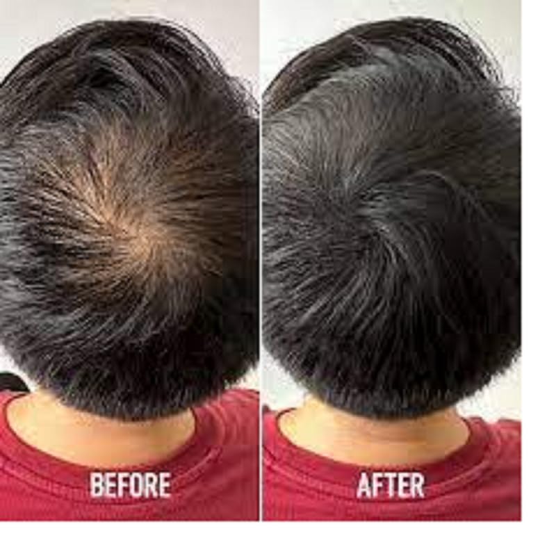Easy to Use Hairline Shadow Powder Stick 10 g - Image 2