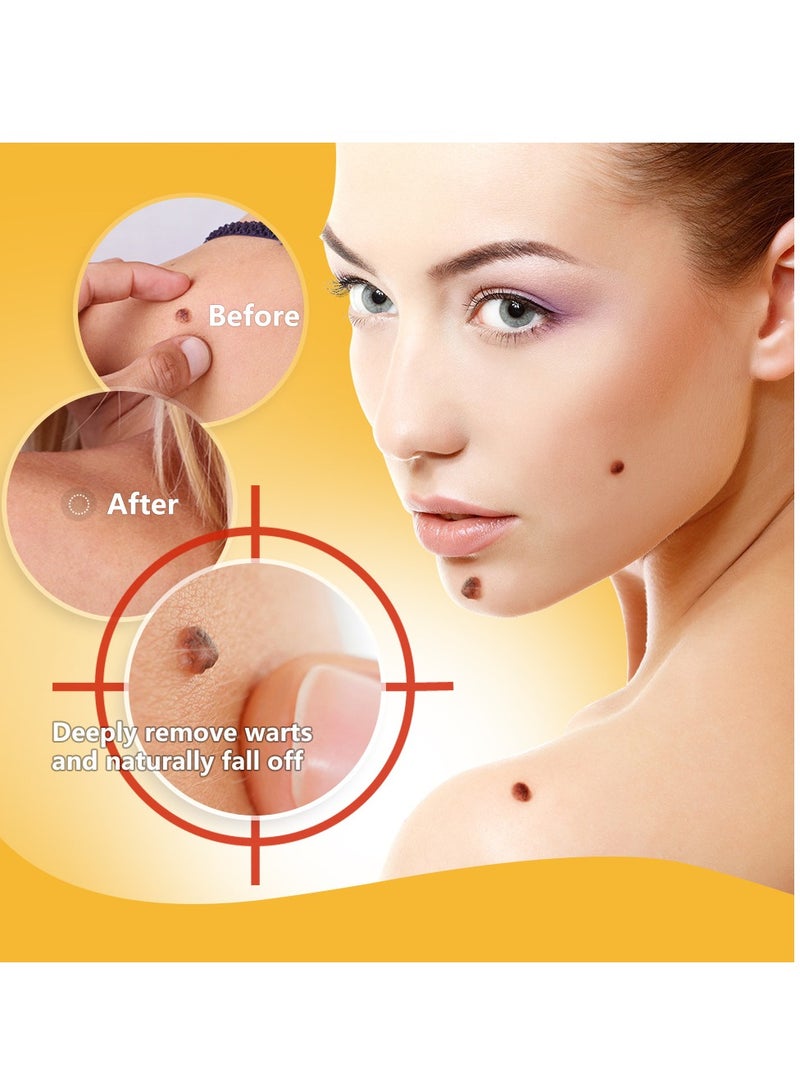 سوميفون مرهم إزالة الثآليل بسم النحل، مكون من 3 قطع، لإزالة الثآليل والشامات وتنعيم البشرة - Image 3