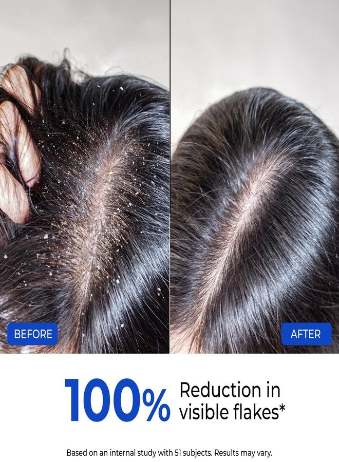 Conscious Chemist® Anti-Dandruff Ultra Hydrating Conditioner 100 ml | Reduces Visible Flakes & Removes Flaky Buildup | 72 Hr Moisture Lock | Strengthens & Smooths Dry, Frizzy Hair | Lightweight Scalp-Friendly Conditioner with FlakeShield Technology | For Women & Men - Image 5