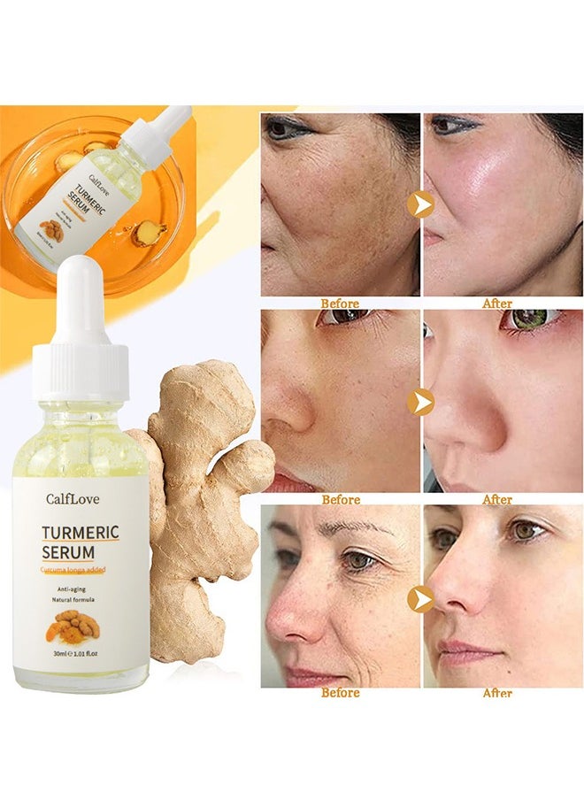 CalfLove - 1PC Turmeric and Vitamin C Face Serum, Turmeric Serum for Dark Spots, Anti Aging Serum, Moisturizing Face Serum for Dull & Dry Skin, Smoothing, Repair Skin Suitable for All Skin Types - Image 1