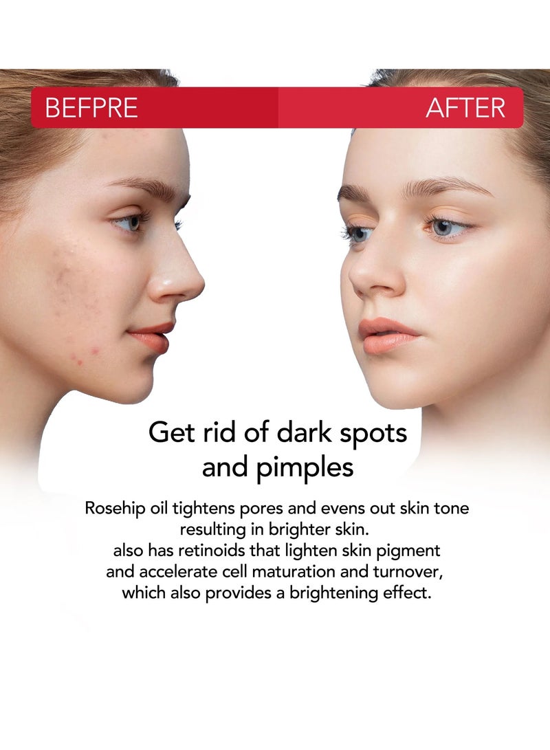 ALIVER زيت ثمر الورد مع ديرما رولر لنمو الشعر والوجه والشعر، زيت بذور ثمر الورد النقي والمعصور على البارد، زيت ثمر الورد غير المكرر لشعر الوجه والأظافر، زيت الورد العطري للعناية بالبشرة، مرطب - Image 4