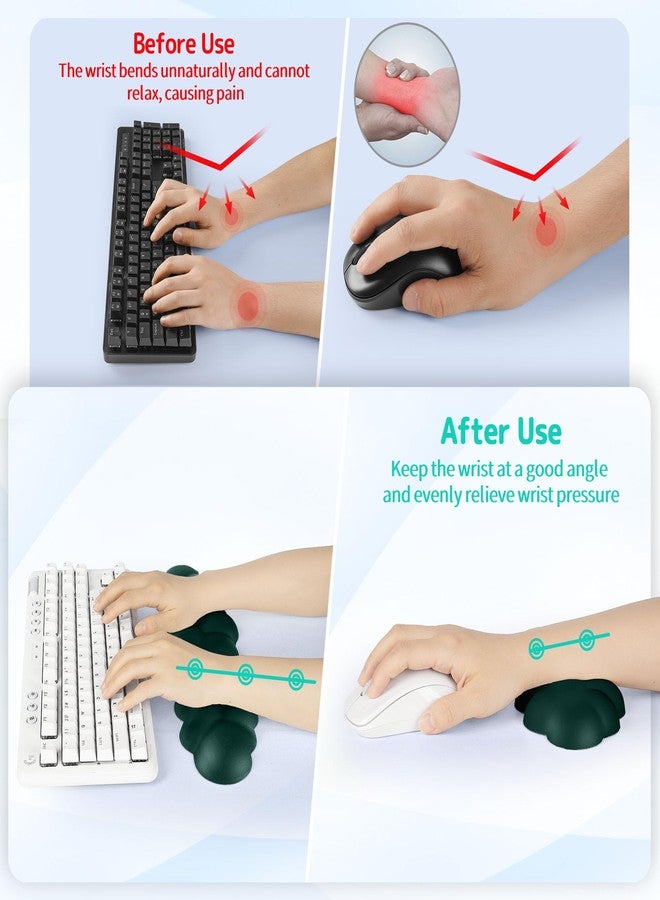 Sushret Wolke Wrist Rest Keyboard, Ergonomic Cloud Palm Rest Keyboard with PU Leather Memory Foam, Cute Clouds Wrist Rest Pad for PC/Gaming/Arm Hand Pad/Computer - Dark Green - Image 3