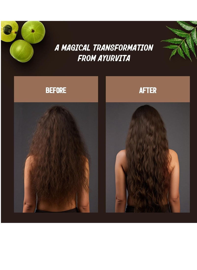 AYURVITA - Restorative Hair Oil - Amla for Strengthening & Neem for Preventing Dryness and Dandruff - For Dry, Damaged Hair Growth - For Men & Women - 2 fl oz - Image 1