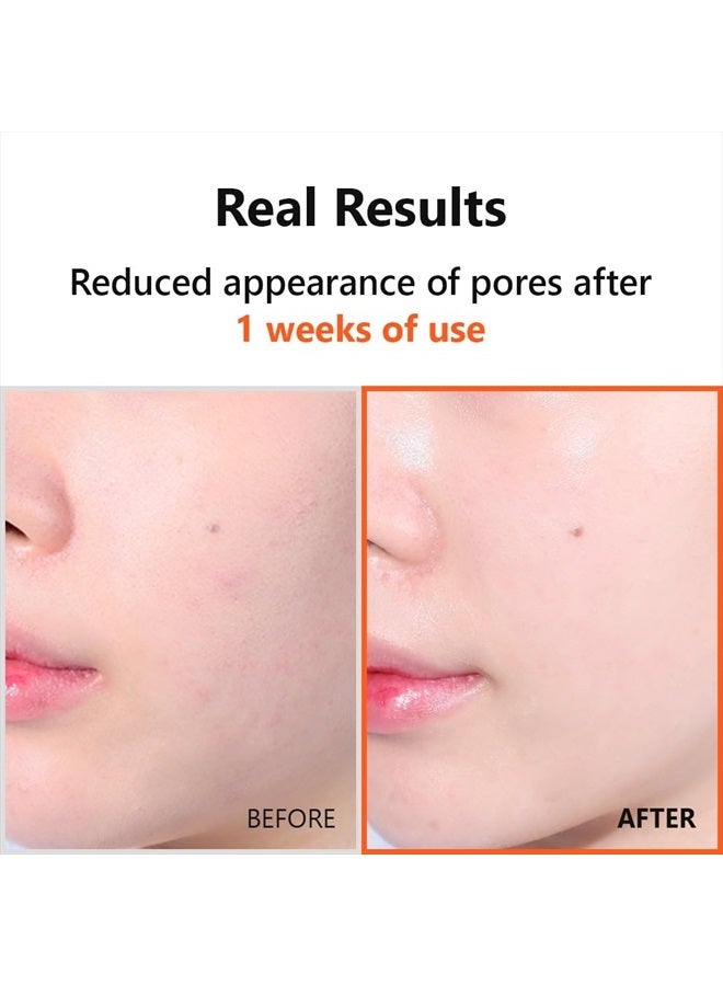 IsNtree مصل هايبر نياسيناميد 20 20 مل - Image 4