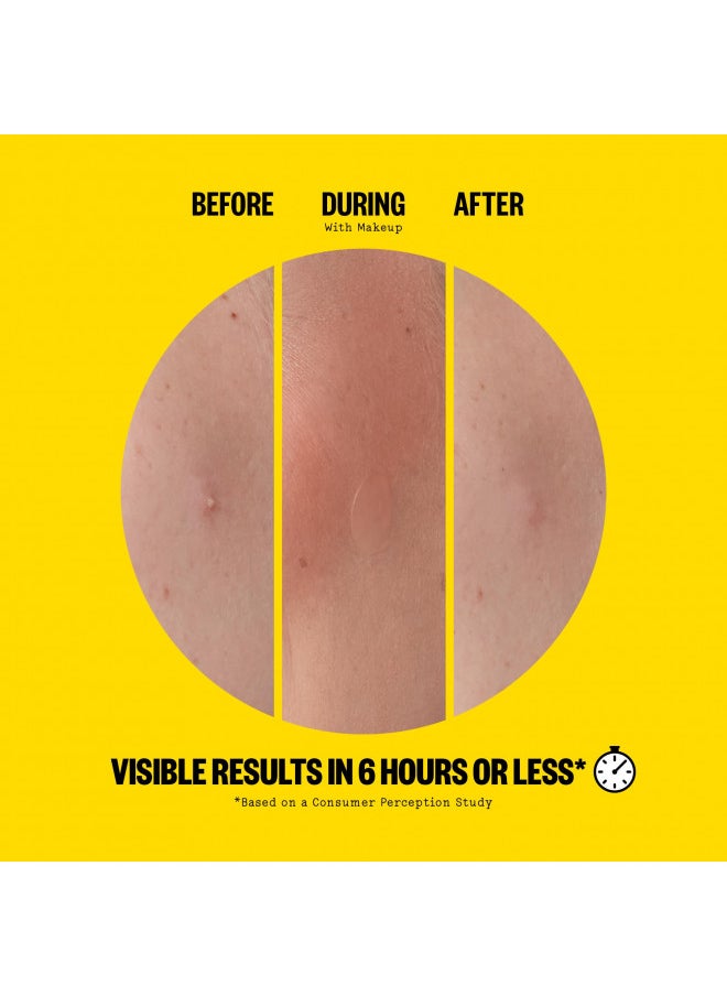PEACE OUT - PEACE OUT Skincare Acne Day Dot Jumbo, 6-hour Fast Acting Sheer Hydrocolloid Pimple Patches with Salicylic Acid, Ultra-Thin, Virtually Invisible, Quickly Clear Breakouts, Blemishes and Zits, 40 dots - Image 1