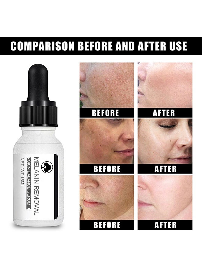 إيلهو سيروم توازن البشرة لإزالة الميلانين، سيروم النياسيناميد، سيروم تصحيح البقع الداكنة لتفتيح الوجه، كريم وجه لتفتيح البشرة وترطيبها ومكافحة الشيخوخة، سيروم عناية بالبشرة ناعم ومفتح لإصلاح البشرة 15 مل - Image 4
