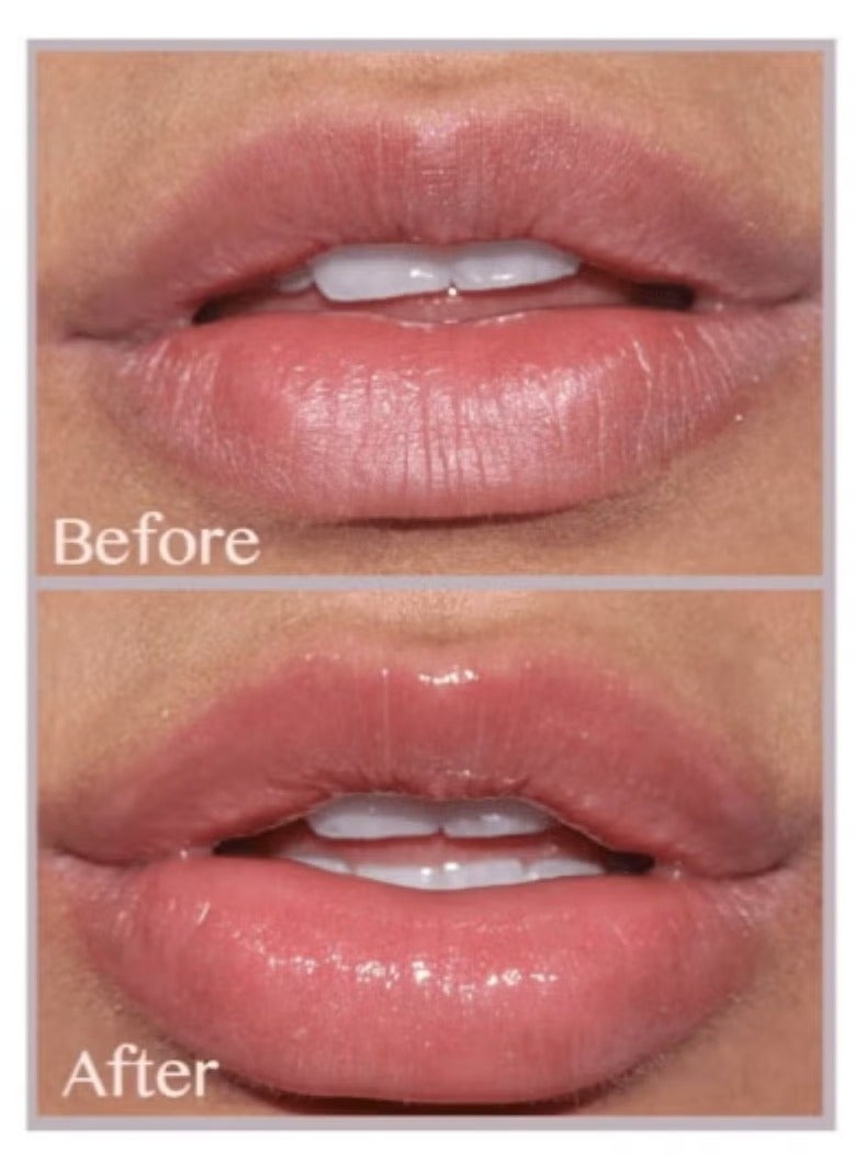 Flexitol Lip Balm Berry 10g - Image 2