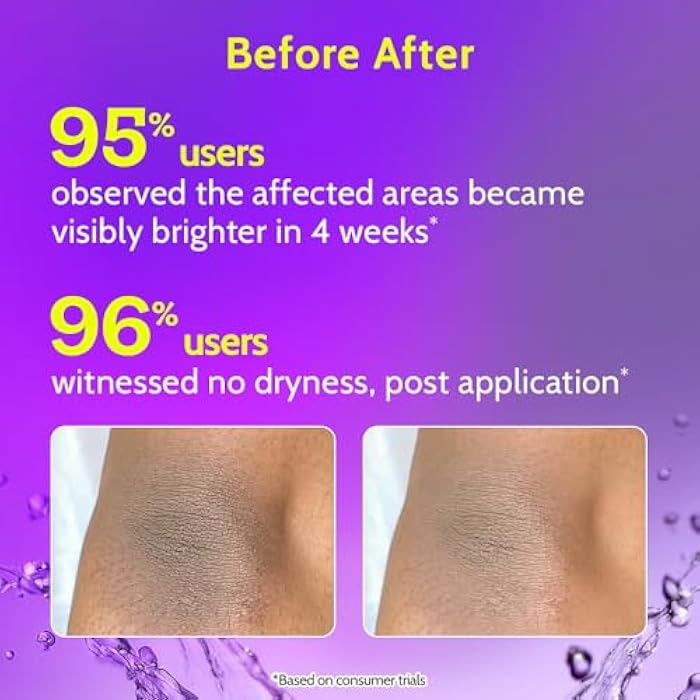 Chemist at Play Roll On Serum For Neck, Knee & Elbow With 6% Vitamin C+ Hyaluronic Acid + AHAs + Niacinamide + Ceramides | Exfoliates, Removes Pigmentation, and Hydrates Dry Skin | 1.4 fl oz. - Image 4