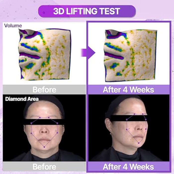 BIOHEAL BOH أمبولات BIOHEAL BOH Probioderm™ 3D لرفع البشرة 1.01 أونصة سائلة (30 مل) | سيروم مرونة متقدم لبشرة مشدودة ومحددة | تركيبة رفع ثلاثية الأبعاد قوية مع البروبيوتيك والببتيدات للعناية اليومية بالبشرة - Image 3
