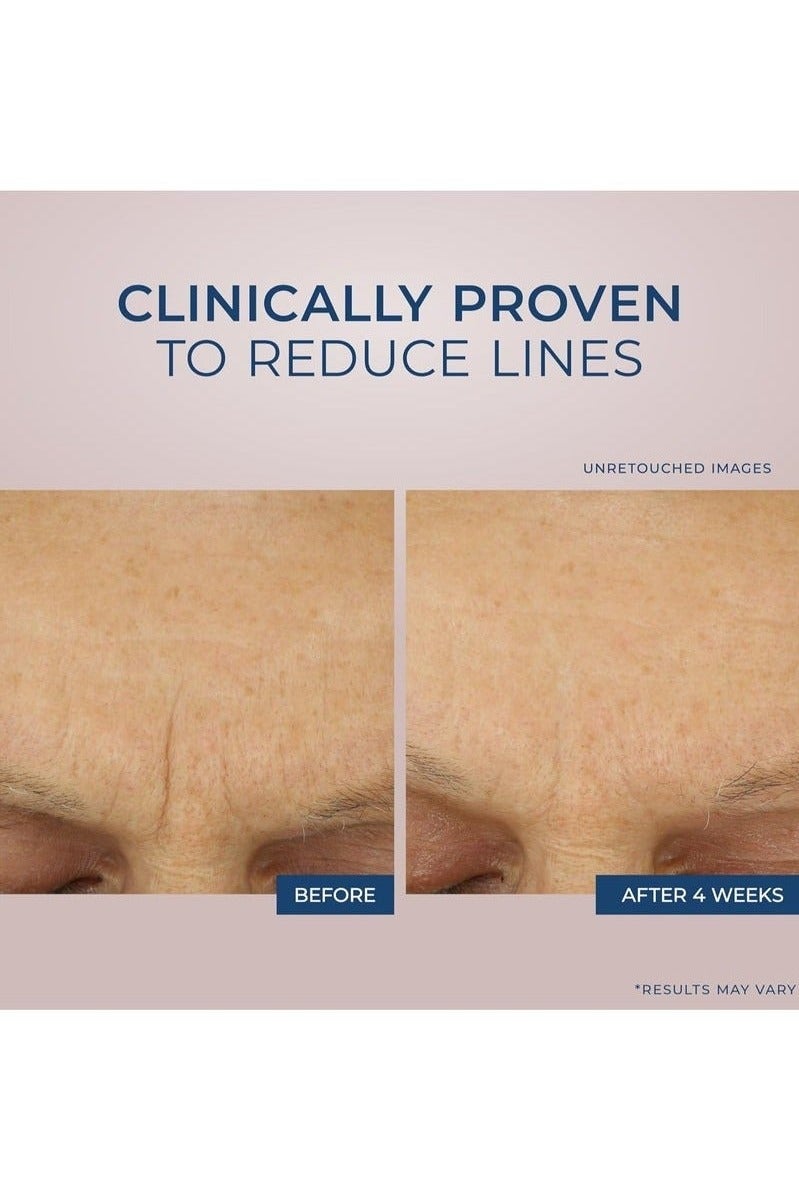 RoC Retinol Correxion Max Daily Hydration Anti-Aging Face Moisturizer with Hyaluronic Acid, Oil Free Skin Care Cream for Fine Lines, Dark Spots, Post-Acne Scars, 1.7 Ounces - Image 3