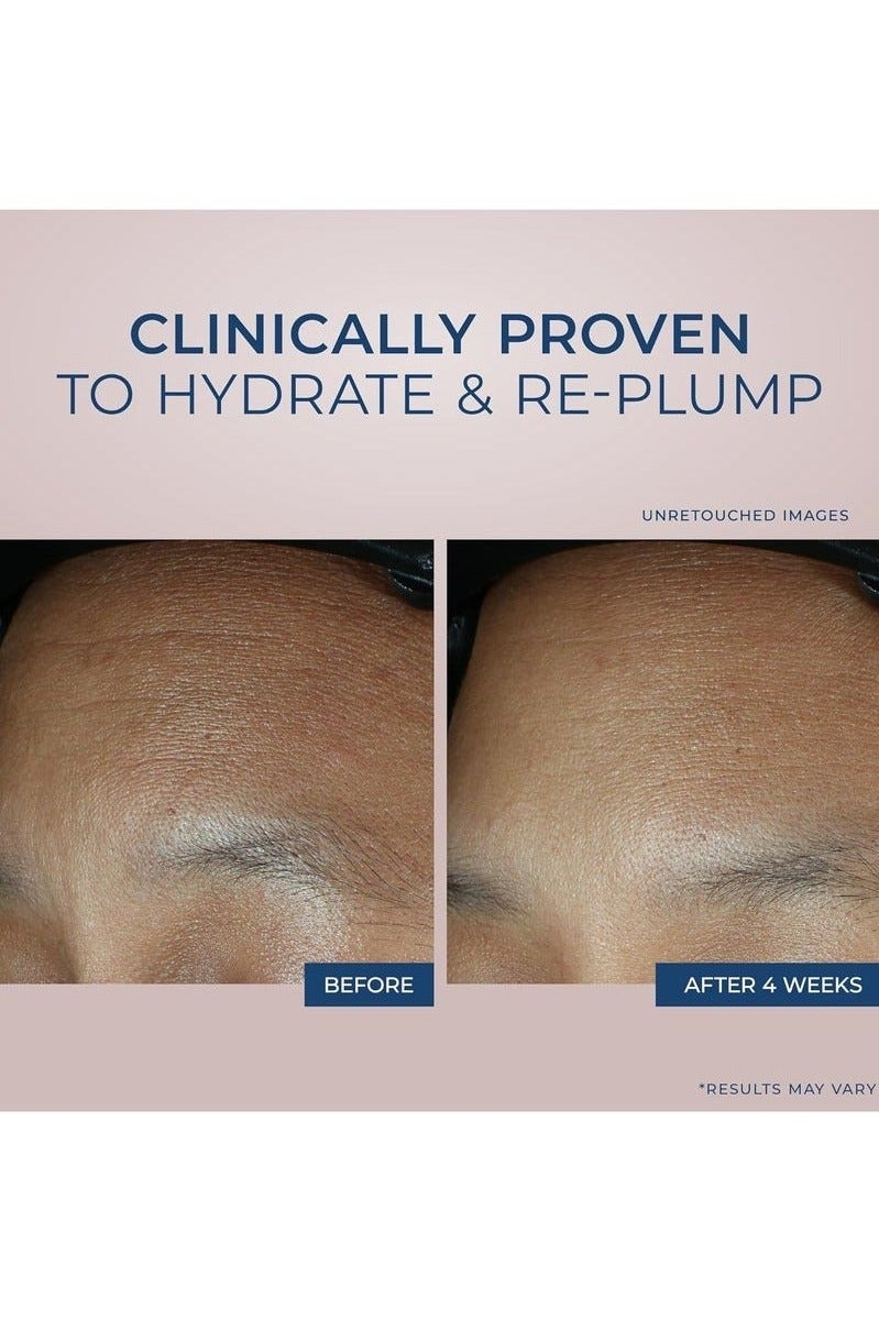 RoC Retinol Correxion Max Daily Hydration Anti-Aging Face Moisturizer with Hyaluronic Acid, Oil Free Skin Care Cream for Fine Lines, Dark Spots, Post-Acne Scars, 1.7 Ounces - Image 5