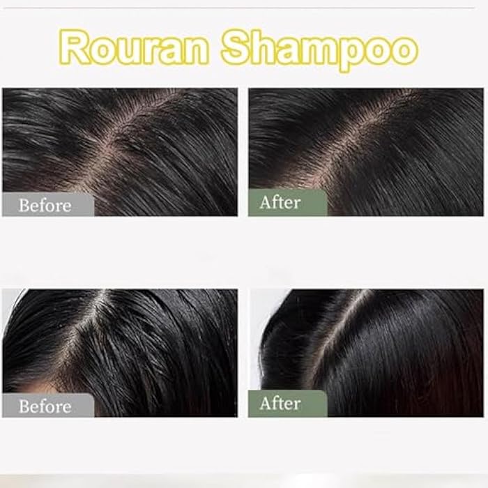Rouran Shampoo, Rouran Anti Hairloss Shampoo, Rouran Hair Shampoo 500 Ml/17.6 Fl Oz, Suitable for All Hair Types, Nourishing & Moisturizing, Natural Ingredients (1pcs) - Image 4