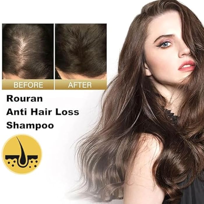 Rouran Shampoo, Rouran Anti Hairloss Shampoo, Rouran Hair Shampoo 500 Ml/17.6 Fl Oz, Suitable for All Hair Types, Nourishing & Moisturizing, Natural Ingredients (1pcs) - Image 5