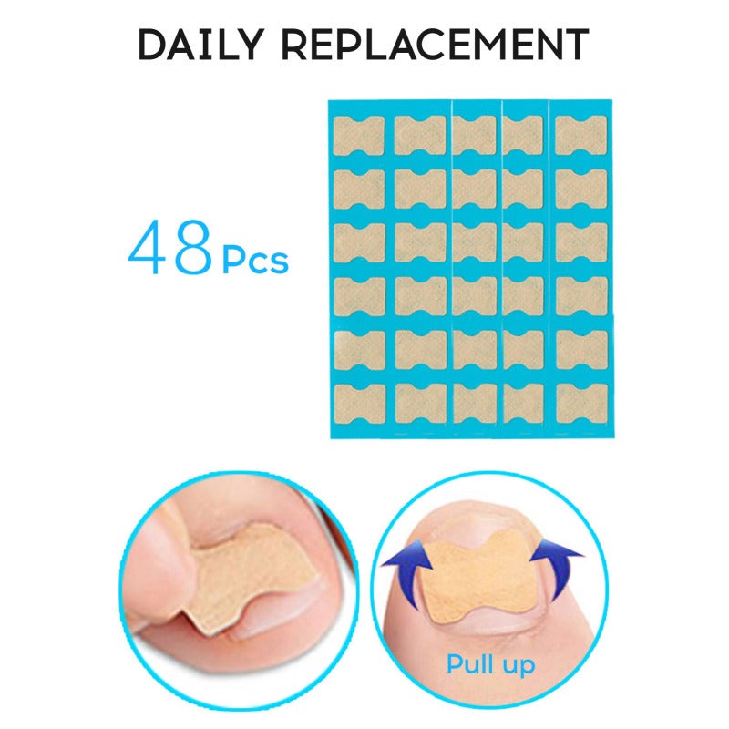 48Pcs Jelly Glue Self-adhesive Ingrown Teonail Corrector Stickers Simple Paste Daily Replacement Ingrown Teonail Corrector Tool - Image 2