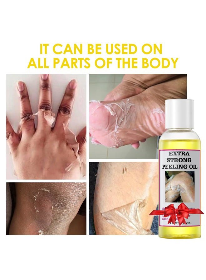 Yafusipe Peeling Oil For Dark Skin, Yellow With Salicylic Sodium Hyaluronate, Strong Extra Strength, Exfoliating Solution Body All Skin Type - 110Ml/3.66 Oz - Image 2