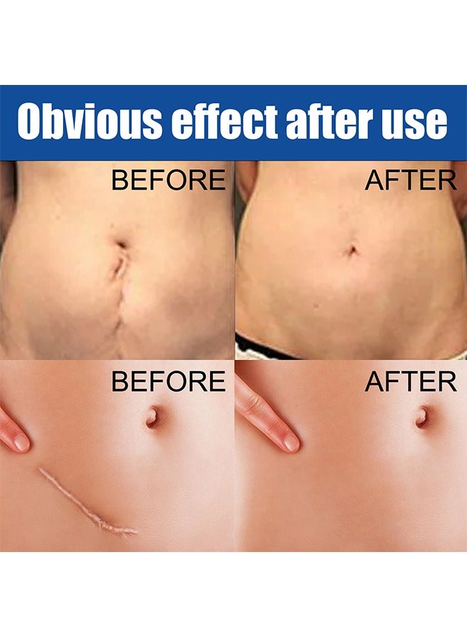 إيلهو كريم الندبة - جل جديد جل سيليكون متقدم من كريم الندبات ، كريم العناية بالبشرة كريم إصلاح البشرة - Image 4