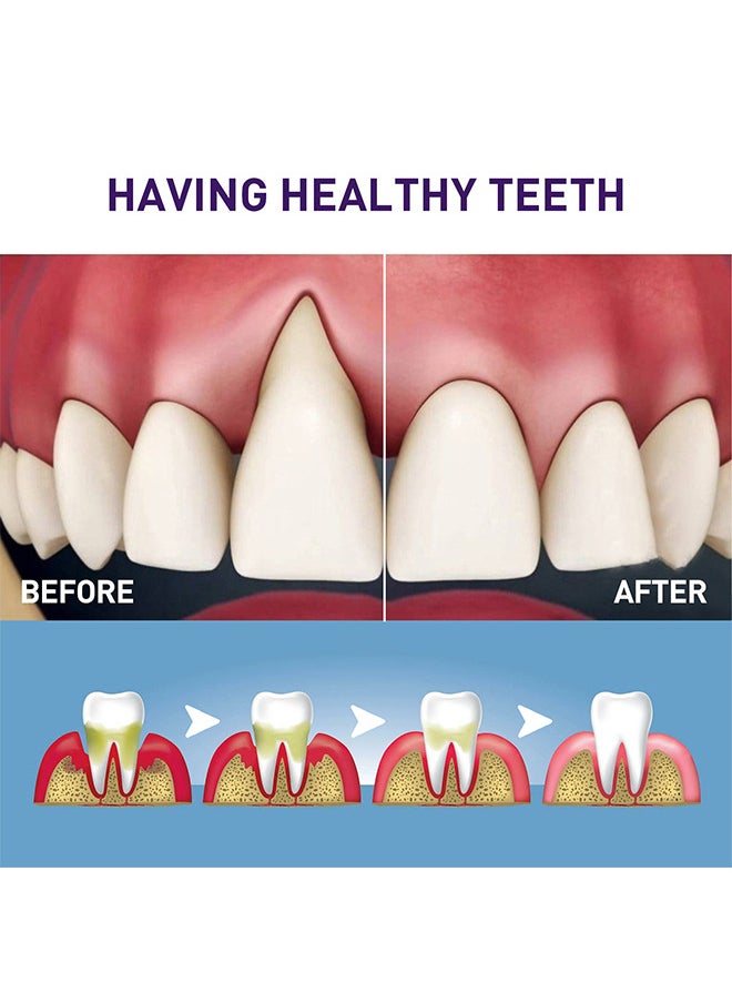 West&Month Gingiva White Gum Corrector Pen 3ML, Removes Teeth Stains Color Corrector, Teeth Whitening Liquid Pen For Repairing Gumsm, Removes Stains, Tartar, Yellow Teeth  - Image 4