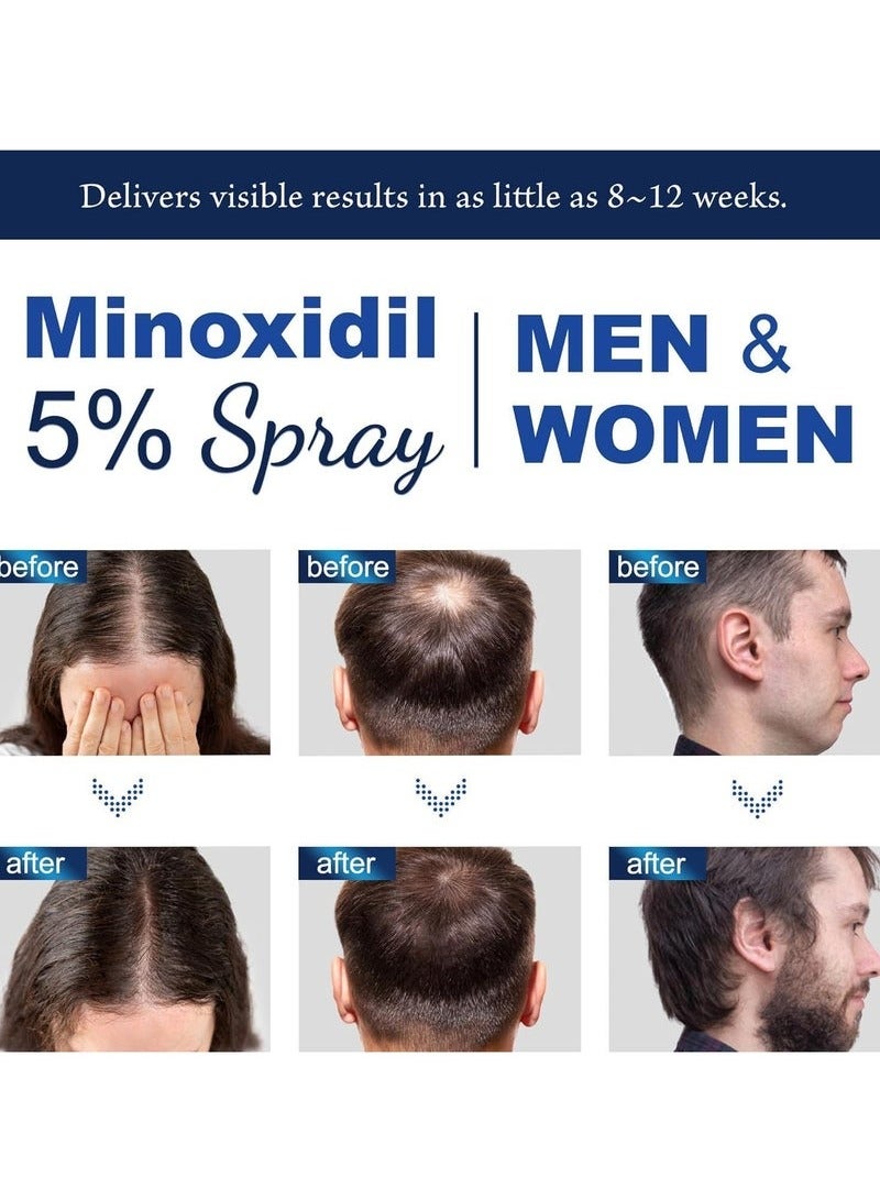 HOEGOA Minoxidil 5% for Men (120 ML), Advanced Minoxidil Spray with Provitamin B5 and Castor Seed Extract, Minoxidil Extract Serum for Hair Loss, Beard Restoration - Image 2